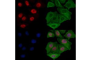ABIN7094558 and ABIN7098607 staining Hela cells by IF/ICC.