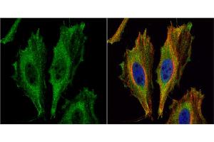 ICC/IF Image Aspartoacylase antibody [N1C3-2] detects Aspartoacylase protein at cytoplasm by immunofluorescent analysis. (ASPA Antikörper)