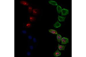 ABIN6263619 and ABIN6278595 staining Hela cells by IF/ICC. (Neurofibromin 1 Antikörper  (C-Term))