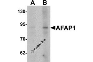 Western Blotting (WB) image for anti-Actin Filament Associated Protein 1 (AFAP1) (N-Term) antibody (ABIN1031217)