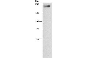 Western Blot analysis of Mouse lung tissue using IQGAP3 Polyclonal Antibody at dilution of 1:850 (IQGAP3 Antikörper)