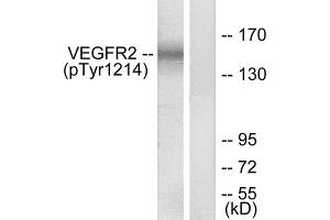 Western blot analysis of extracts from HepG2 cells, treated with Na3VO4 (0. (VEGFR2/CD309 Antikörper  (pTyr1214))