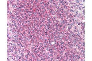 Anti-MCL1 antibody IHC of human spleen. (MCL-1 Antikörper)