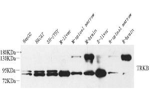 Western Blot analysis of various samples using NTRK2 Polyclonal Antibody at dilution of 1:1000. (TRKB Antikörper)