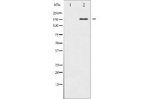 Western blot analysis of ASK1 expression in MDA-MB-435 whole cell lysates,The lane on the left is treated with the antigen-specific peptide. (ASK1 Antikörper  (N-Term))