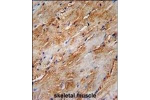 G8b (M1LC3B)-T93/Y99 Antibody (Center) 1802e immunohistochemistry analysis in forlin fixed and paraffin embedded hun skeletal muscle followed by peroxidase conjugation of the secondary antibody and DAB staining. (APG8b (AA 74-106) Antikörper)