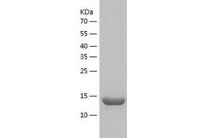 CARHSP1 Protein (AA 1-147) (His tag)