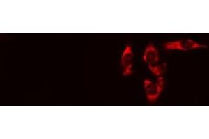 ABIN6275097 staining HeLa cells by IF/ICC. (RNF144B Antikörper  (Internal Region))