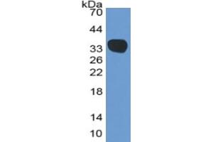 WB of Protein Standard: different control antibodies against Highly purified E. (Complement C4 ELISA Kit)