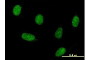 Immunofluorescence of purified MaxPab antibody to HNRPK on HeLa cell. (HNRNPK Antikörper  (AA 1-463))