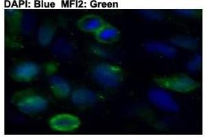 Immunofluorescent staining of HeLa cells with MFI2 polyclonal antibody  at 1:50 dilution. (MFI2 Antikörper  (C-Term))