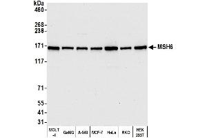 Western Blotting (WB) image for anti-MutS Homolog 6 (E. Coli) (MSH6) (AA 1310-1360) antibody (ABIN7453979)