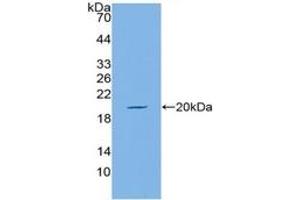 Western Blotting (WB) image for Mucin 5AC, Oligomeric Mucus/gel-Forming (MUC5AC) ELISA Kit (ABIN6574198)