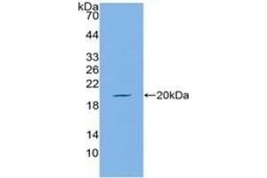 WB of Protein Standard: different control antibodies against Highly purified E. (MUC5AC ELISA Kit)