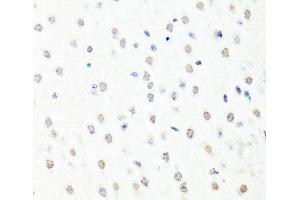 Immunohistochemistry of paraffin-embedded Mouse brain using CHRAC1 Polyclonal Antibody at dilution of 1:100 (40x lens). (CHRAC1 Antikörper)