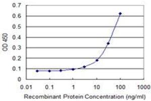 Image no. 4 for anti-Aldehyde Dehydrogenase 4 Family, Member A1 (ALDH4A1) (AA 1-564) antibody (ABIN599053) (ALDH4A1 Antikörper  (AA 1-564))