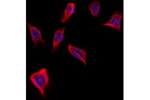 ABIN6262005 and ABIN6273249 staining Hela by IF/ICC. (GMFG Antikörper  (Internal Region))