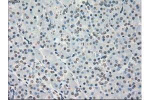 Immunohistochemical staining of paraffin-embedded colon tissue using anti-PPP5Cmouse monoclonal antibody. (PP5 Antikörper)