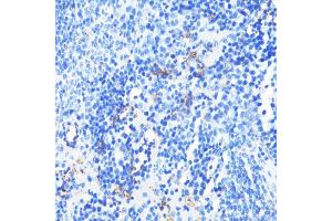 Immunohistochemistry (IHC) image for anti-Integrin alpha-L (ITGAL) (AA 26-306) antibody (ABIN3015542)