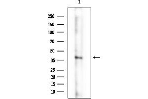 Western blot analysis of lysates from HepG2 cells, using CED6 Mouse Monoclonal Antibody at 1/1000 dilution.