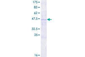 RARRES3 Protein (AA 1-164) (GST tag)