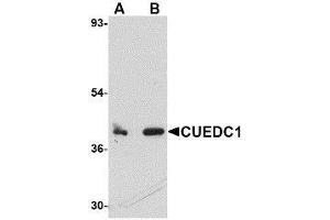 Western blot analysis of CUEDC1 in rat liver tissue lysate with AP30261PU-N CUEDC1 antibody at (A) 0. (CUEDC1 Antikörper  (C-Term))