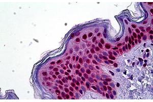 Human Skin: Formalin-Fixed, Paraffin-Embedded (FFPE) (SETD8 Antikörper  (N-Term))