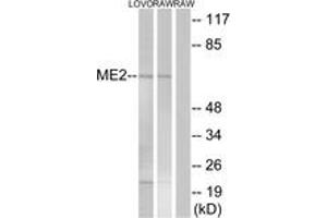 Western blot analysis of extracts from RAW264. (NAD-ME Antikörper  (AA 201-250))