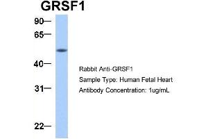 Western Blotting (WB) image for anti-G-Rich RNA Sequence Binding Factor 1 (GRSF1) (Middle Region) antibody (ABIN2778788)