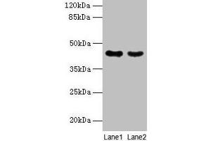 Western blot All lanes: MAS1L antibody at 2 μg/mL Lane 1: Colo320 whole cell lysate Lane 2: Hela whole cell lysate Secondary Goat polyclonal to rabbit IgG at 1/10000 dilution Predicted band size: 43 kDa Observed band size: 43 kDa (MAS1L Antikörper  (AA 318-378))