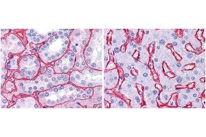 Anti collagen IV antibody (1:400, 45 min RT) showed strong staining in FFPE sections of human kidney (Left) with strong red staining observed in glomeruli and liver (Right) with strong staining in sinusoids. (Collagen IV Antikörper  (Biotin))