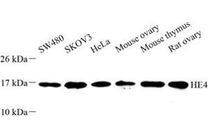 Western blot analysis of HE4 (ABIN7076209) at dilution of 1: 500 (WFDC2 Antikörper)