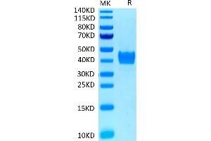 Human CD52 on Tris-Bis PAGE under reduced conditions. (CD52 Protein (CD52) (AA 25-36) (mFc Tag))