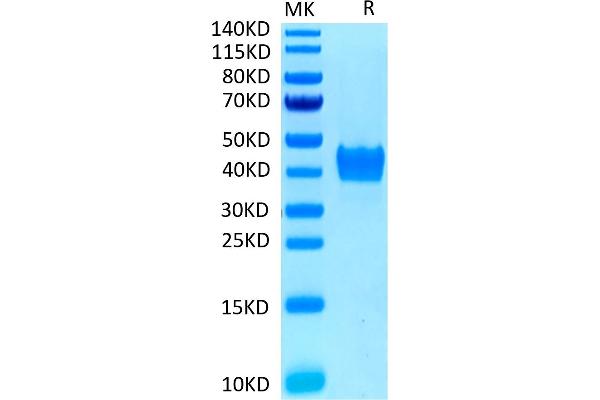 CD52 Protein (CD52) (AA 25-36) (mFc Tag)