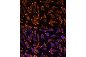 Immunofluorescence analysis of L929 cells using TNFRSF11A Polyclonal Antibody (ABIN6127589, ABIN6149310, ABIN6149312 and ABIN6217357) at dilution of 1:100 (40x lens). (TNFRSF11A Antikörper  (AA 466-616))
