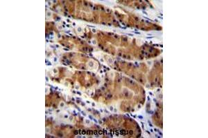 CCDC84 Antibody (N-term) immunohistochemistry analysis in formalin fixed and paraffin embedded human stomach tissue followed by peroxidase conjugation of the secondary antibody and DAB staining. (CCDC84 Antikörper  (N-Term))