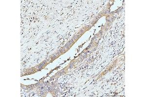 IHC analysis of GIT1 using anti-GIT1 antibody (ABIN7601683). (GIT1 Antikörper  (AA 415-736))