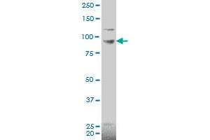 PDE6C polyclonal antibody (A01), Lot # 060116JC01 Western Blot analysis of PDE6C expression in HL-60 . (PDE6C Antikörper  (AA 3-100))