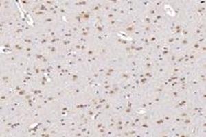 Immunohistochemistry (Paraffin-embedded Sections) (IHC (p)) image for anti-T-Box 19 (TBX19) antibody (ABIN7075815)