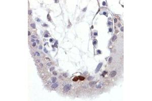 Immunohistochemistry staining of Wild-type p53 expressed in human trophoblast (paraffin-embedded sections). (p53 Antikörper  (pSer392))