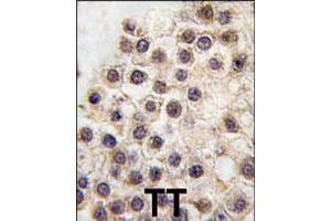 Formalin-fixed and paraffin-embedded human testis tissue reacted with ARID3B polyclonal antibody  , which was peroxidase-conjugated to the secondary antibody, followed by DAB staining. (ARID3B Antikörper  (C-Term))