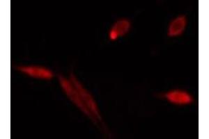 ABIN6275512 staining  HeLa cells by IF/ICC. (RUFY1 Antikörper  (Internal Region))