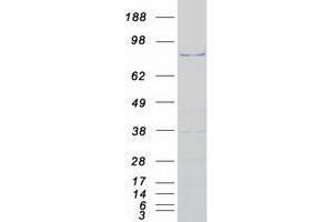 Western Blotting (WB) image for NOP2/Sun Domain Family, Member 2 (NSUN2) protein (Myc-DYKDDDDK Tag) (ABIN2727652)