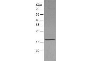 Western Blotting (WB) image for Ubiquitin-Conjugating Enzyme E2F (UBE2F) (AA 1-185) protein (His-IF2DI Tag) (ABIN7125616)