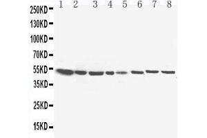 Lane 8: COLO320 Cell Lysate (HSD17B4 Antikörper  (C-Term))
