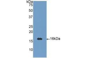 Detection of Recombinant NT3, Human using Polyclonal Antibody to Neurotrophin 3 (NT3)