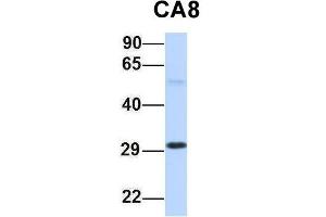 Host:  Rabbit  Target Name:  CA8  Sample Type:  Human Fetal Lung  Antibody Dilution:  1. (CA8 Antikörper  (Middle Region))