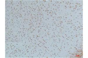 Immunohistochemistry (IHC) analysis of paraffin-embedded Mouse Brain Tissue using CaMKIIbeta/ gamma /delta (Phospho Thr287) Mouse Monoclonal Antibody diluted at 1:200. (CaMKIIbeta/gamma/delta Antikörper  (pThr287))