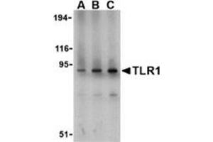 Western blot analysis of TLR1 in mouse spleen lysate with this product at (A) 1, (B) 2, and (C) 4 μg/ml.