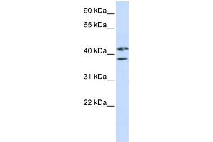WB Suggested Anti-ZRANB2 Antibody Titration:  0. (ZNF265 Antikörper  (Middle Region))